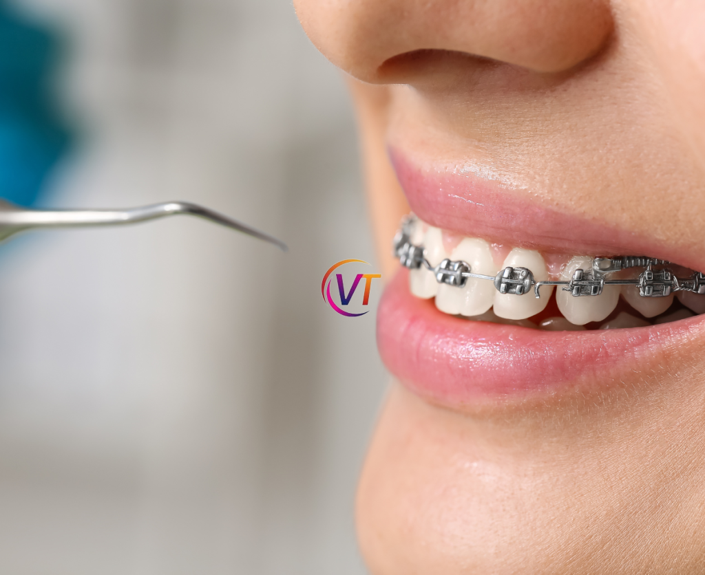 Tooth Filling Services in Vancouver: Ensuring a Healthy Smile