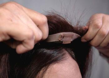 Everything You Need to Know About Hair Toppers