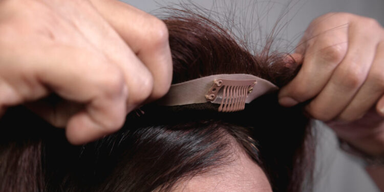 Everything You Need to Know About Hair Toppers