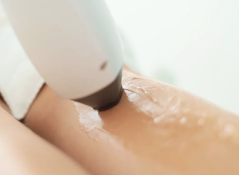 How To Get The Best Results From Your Laser Hair Removal Treatment?