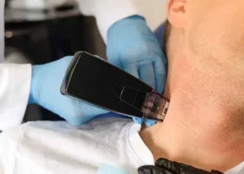 Unlocking a Youthful Glow: The Benefits of Morpheus8 in Sydney