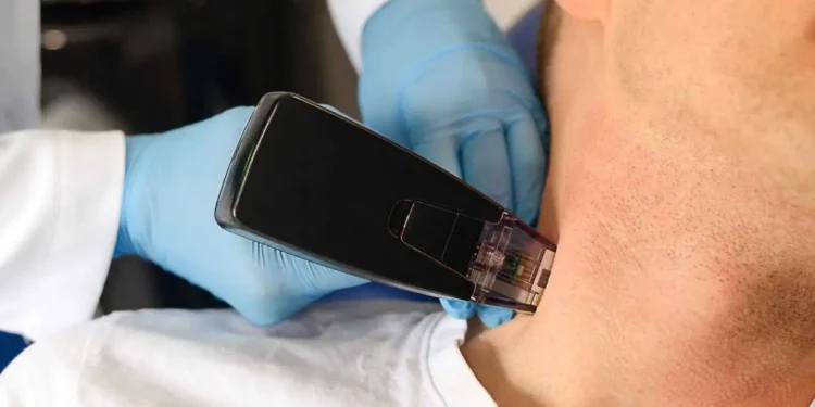 Unlocking a Youthful Glow: The Benefits of Morpheus8 in Sydney