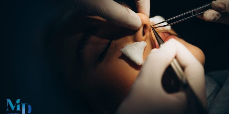 Rhinoplasty